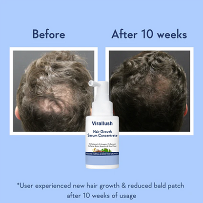 hair-growth-serum-concentrate-7698