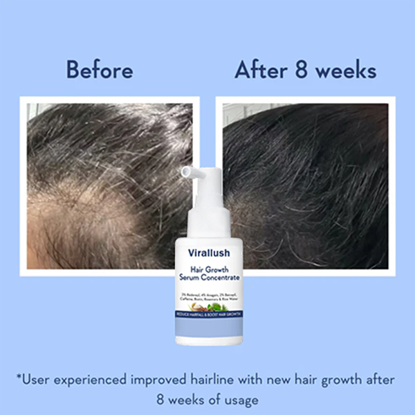 hair-growth-serum-concentrate-7698