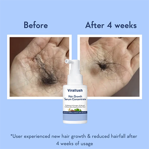 hair-growth-serum-concentrate-7698