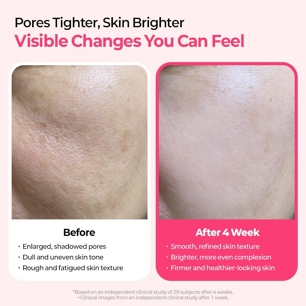 pore-spot-care-duo-5474